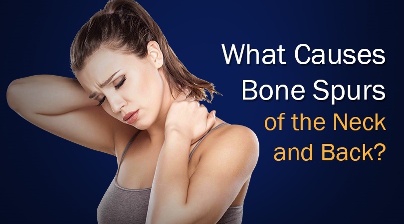 What Causes Bone Spurs Of The Back And Neck 2486
